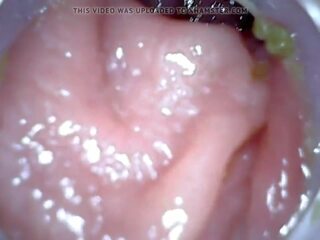 Anale endoscope parte 1, gratis clistere punizione hd x nominale video 04